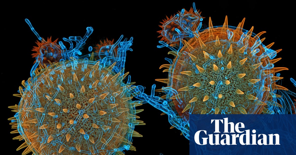 magnifying-the-minuscule:-nikon-small-world-photomicrography-2025